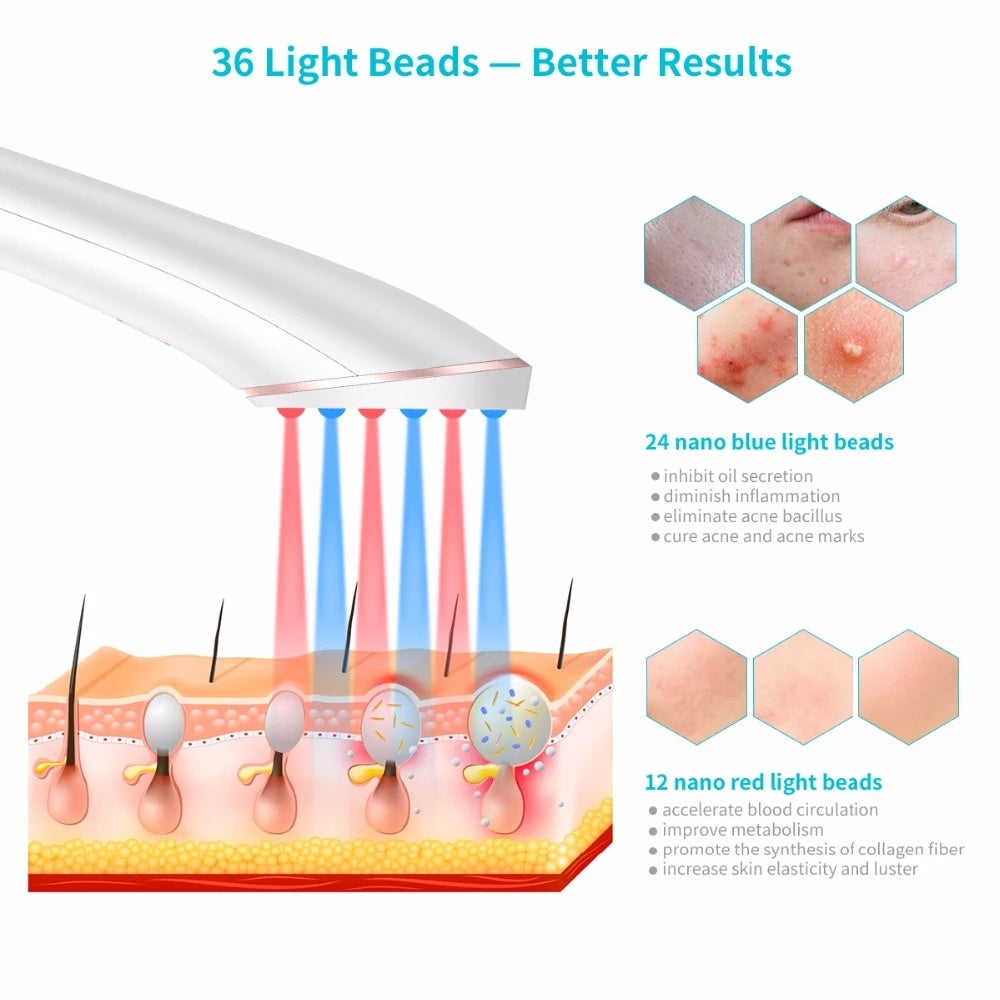 Wireless Acne Eraser: Rechargeable Blue & Red Light Therapy